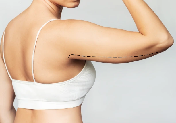 About Arm Lipo in Las Vegas Banner