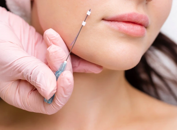 About PDO Thread Lift in Las Vegas, NV