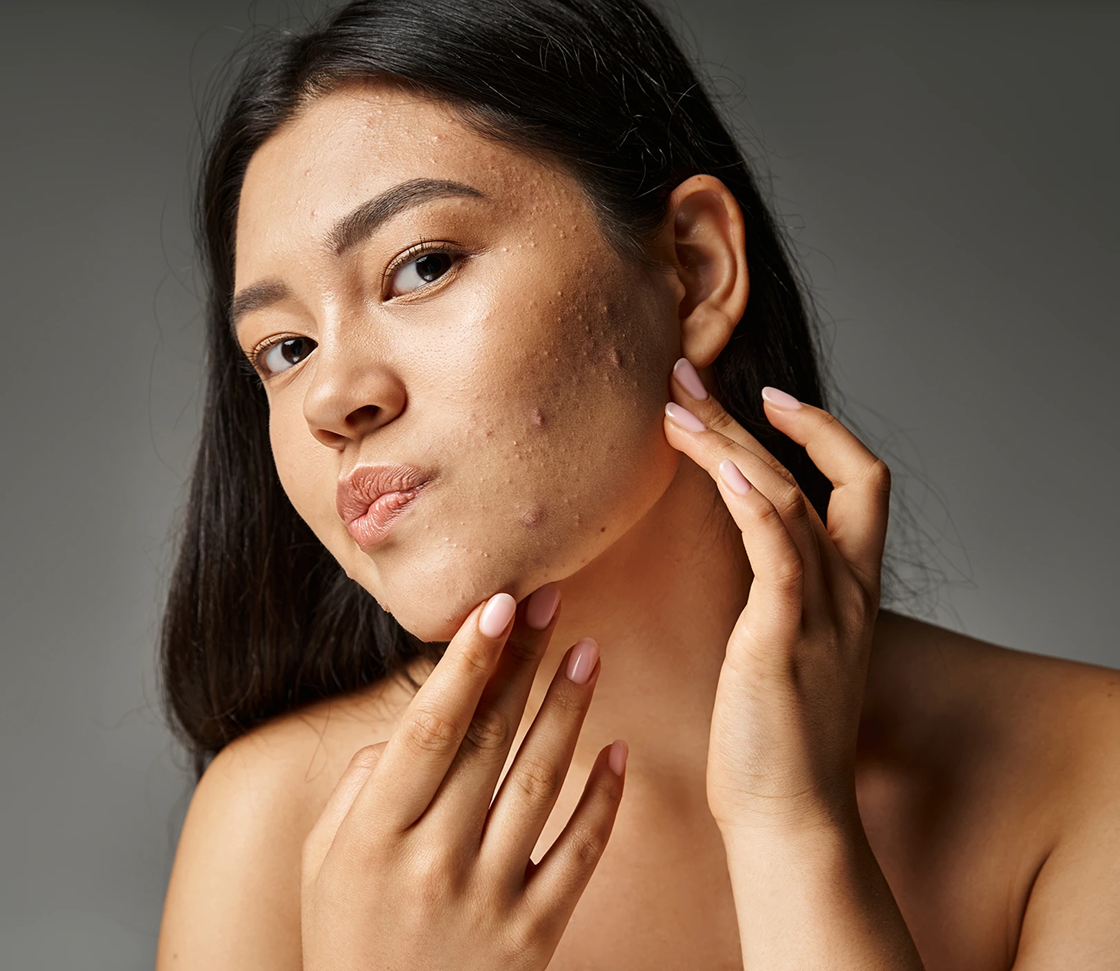 Facial Peels Las Vegas NV: Contraindications Banner