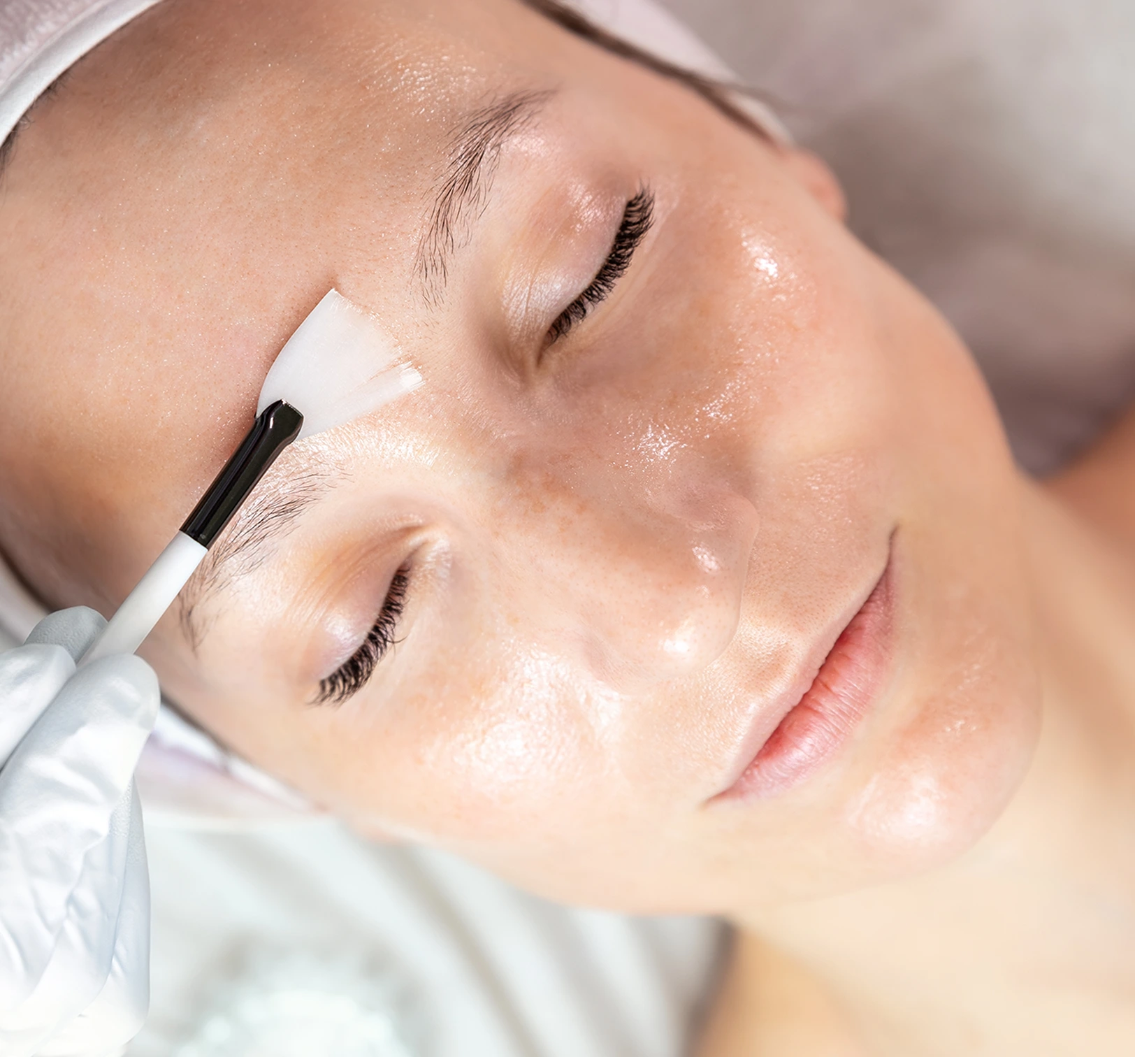 Las Vegas, NV Facial Peels: What Depths of Chemical Peel Treatment Are Best? Banner